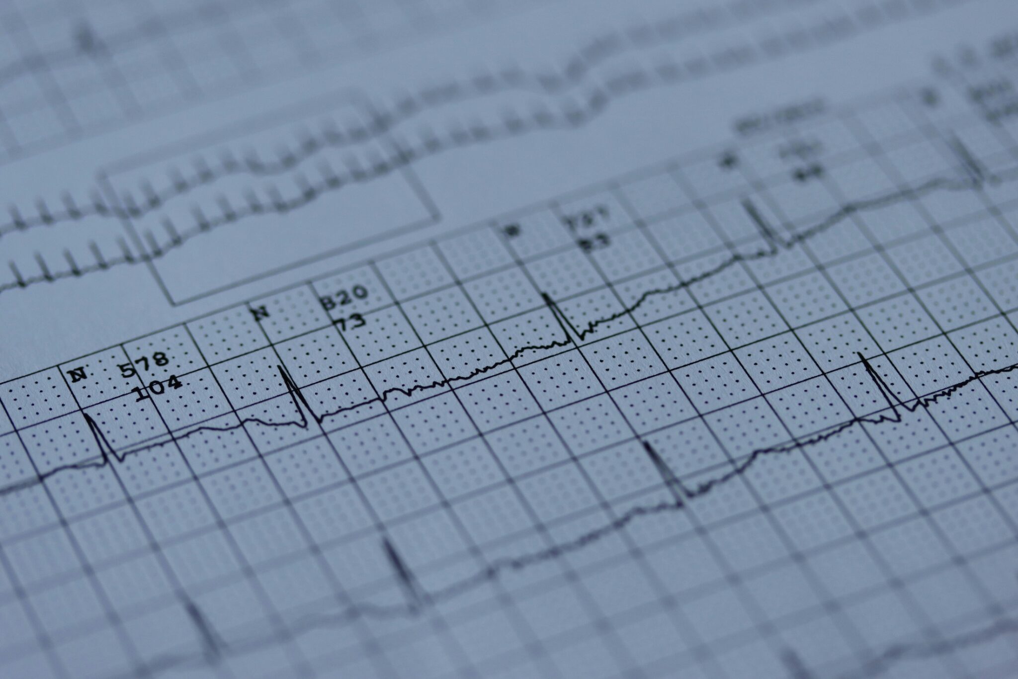 Longevity data, ekg